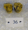 IPS 36