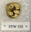 STW 520