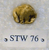 STW 76